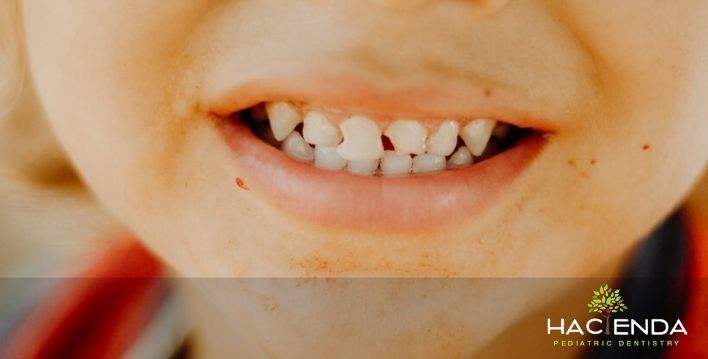 Image of dentist for kids